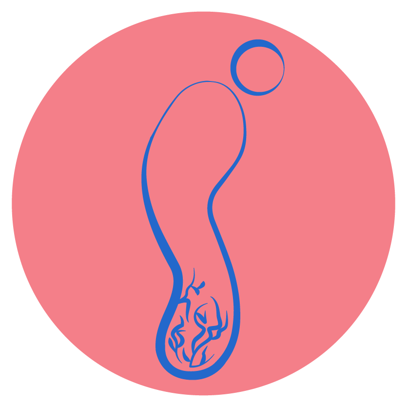 Varicose Veins